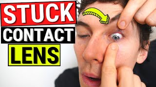 How to Remove a STUCK Contact Lens from the Eye [upl. by Dianna592]