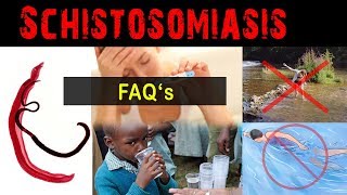 Why amp what is schistosomiasis   FAQ [upl. by Nilloc223]