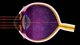 How the Iris Controls Light Entering the Eye  3D Medical Animation Eye  ABP © [upl. by Delisle312]