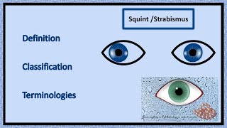 Squint  Definition Classification amp Terminologies [upl. by Asseniv]