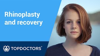 Rhinoplasty how long is recovery [upl. by Asille890]