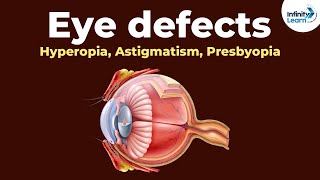 Eye defects  Hyperopia Astigmatism Presbyopia  Dont Memorise [upl. by Eilsek]