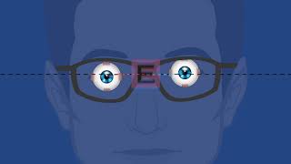 Vertical Heterophoria Binocular Vision Dysfunction Animation [upl. by Ingalls]