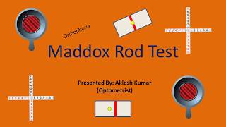 Maddox Rod Test [upl. by Apfelstadt806]