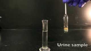 Using a Urinometer [upl. by Hamfurd279]