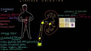 Lithiase urinaire  Docteur Synapse [upl. by Rooney]