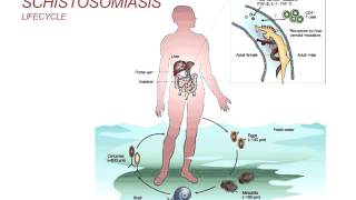 Webinar Schistosomiasis  Diagnosis and Treatment 2014 [upl. by Ecirtap]