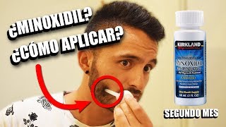 BARBA MINÓXIDIL Segundo mes  ¿Cómo aplicar minoxidil  Adrián Flores [upl. by Notsrik]