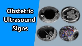 Obstetric Ultrasound Signs [upl. by Neelrihs]