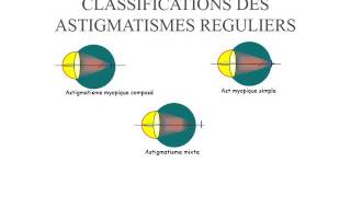 BIOPHYSIQUE Astigmatisme [upl. by Schroeder]