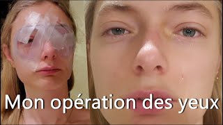 OPÉRATION HYPERMÉTROPIE FORTE ET ASTIGMATISME  Lasik [upl. by Aratak588]