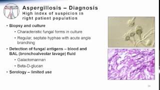 Aspergillosis [upl. by Ientirb]