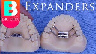 BRACES EXPLAINED Palatal Expanders [upl. by Lamok]