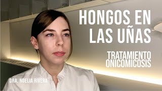 Hongos en las uñas onicomicosis Tratamientos [upl. by Ninaj764]