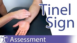 Tinel Sign Wrist  Carpal Tunnel Syndrome Diagnosis [upl. by Rexanna]