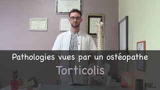 Torticolis  Être Soi [upl. by Jerald]