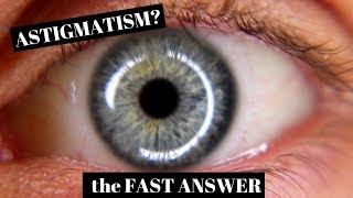 Astigmatism Explained in One Minute [upl. by Lerner486]