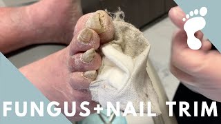 CRAZY THICK NAIL TRIM  FUNGUS [upl. by Alasteir]