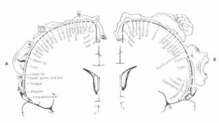 Difference Between Aphasia and Dysarthria [upl. by Yrrot]