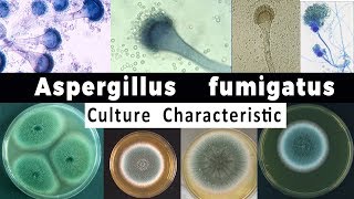 Aspergillus Fumigatus Culture Characteristic [upl. by Seftton]