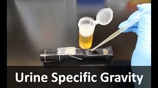 Urine Specific Gravity Refractometer [upl. by Aba]