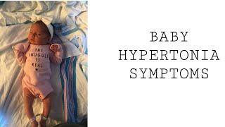 Baby Hypertonia Symptoms [upl. by Greenwald]