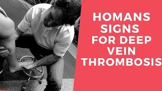 Homans Sign for Deep Vein Thrombosis [upl. by Agle23]