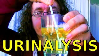 What Urinalysis Strips Tell You [upl. by Rednasyl]