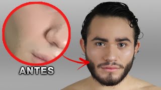 👨🏻 HAZ CRECER TU BARBA FÁCIL CON ESTOS REMEDIOS CASEROS [upl. by Ewens]