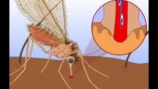 Leishmaniasis life cycle [upl. by Assirahc]