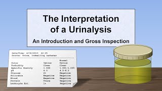 Interpretation of the Urinalysis Part 1  Introduction and Inspection [upl. by Viddah201]