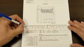 How to Read Your Hearing Test [upl. by Ahsinak]