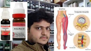 homeopathic medicine for treatment of sciatica explain [upl. by Ettelrac]